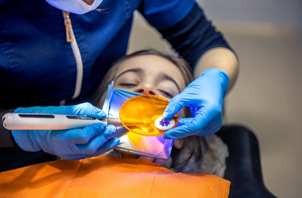 Dentist performing composite filling on young child patient